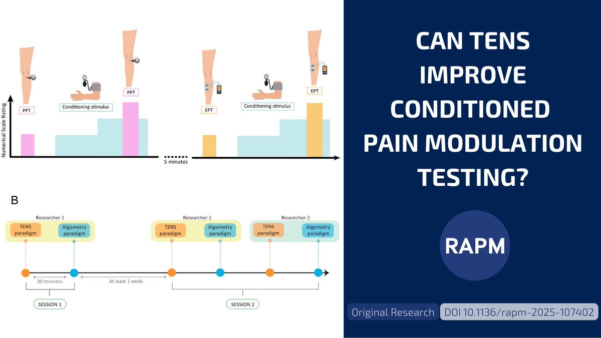 RAPMOnline's tweet photo. 🧠 A simpler way to test conditioned pain modulation?
TENS–pressure cuff paradigm shows:
✔️ Higher reliability
✔️ Greater sensitivity
✔️ Clinical feasibility
🔗 Explore the full study: https://t.co/7tyek9sUex
#PainModulation #TENS #RAPM https://t.co/L0UeZdKlPT
