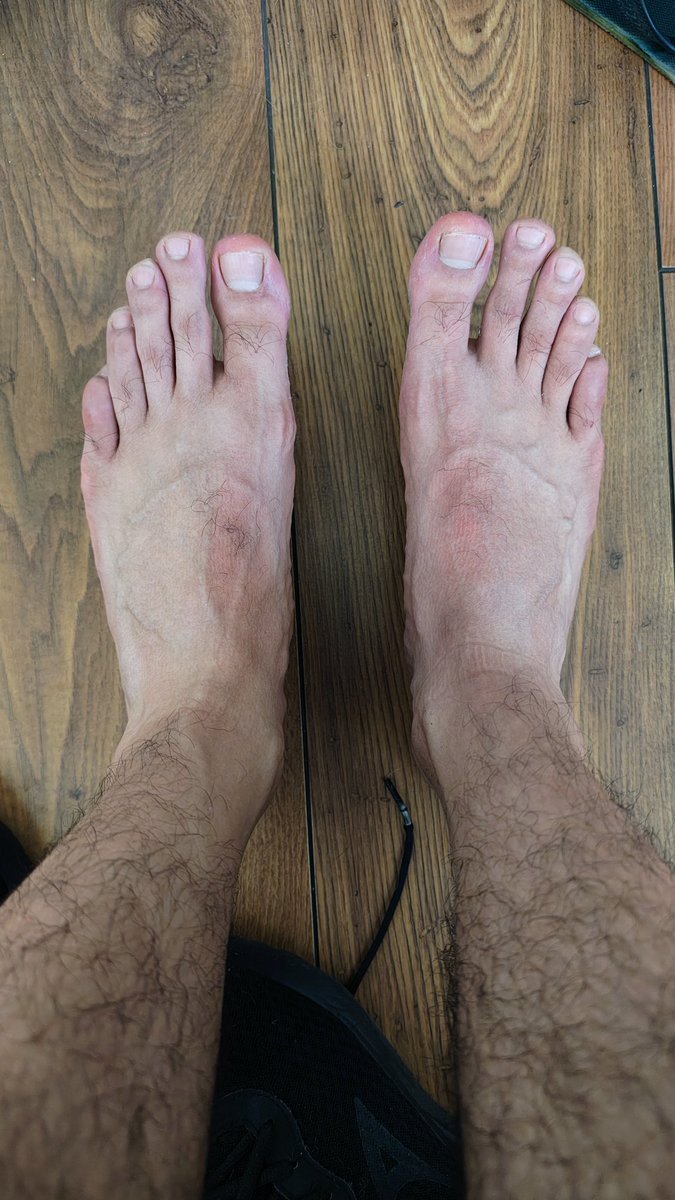 Jrob feet tweet media