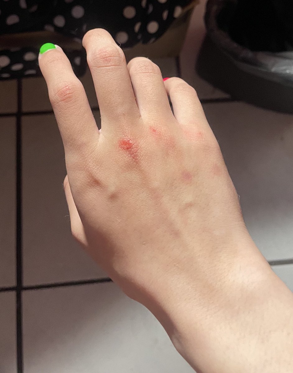 Compassion ໒꒱ || shedtwt tweet media