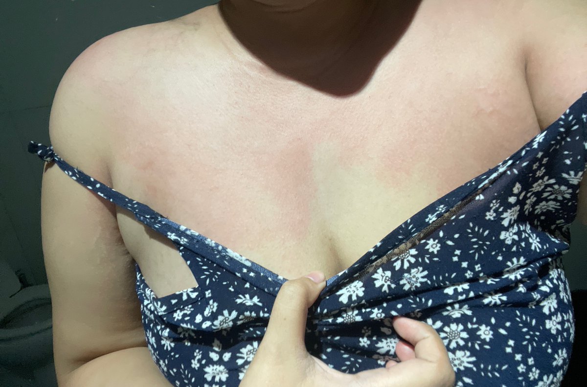 ulan🐝 tweet media