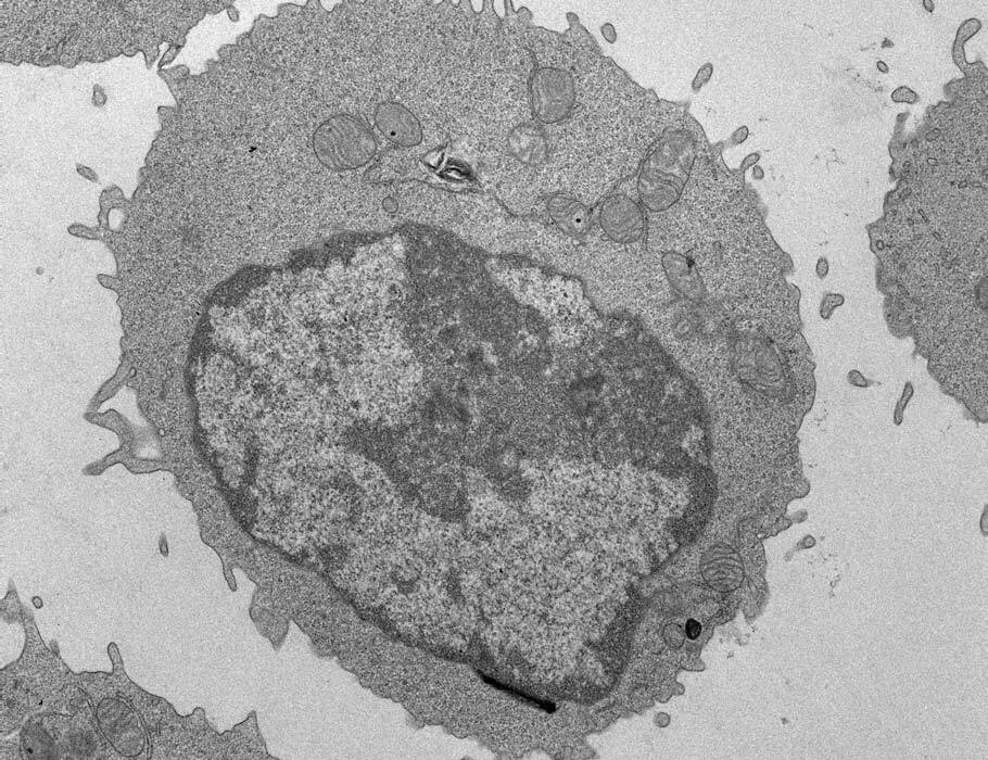 LabWaggoner's tweet photo. Palmitate impairs CD8 T cell mitochondria, suppresses histone acetylation and chromatin accessibility, and blocks effector programs @SciImmunology 
https://t.co/bOyG8Fqly2 🇮🇹 https://t.co/Q02AFYtwpe