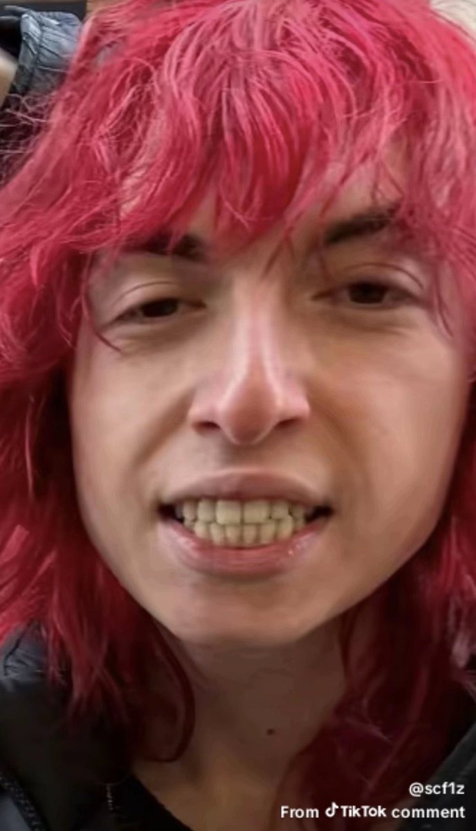 teenboi💀 tweet media