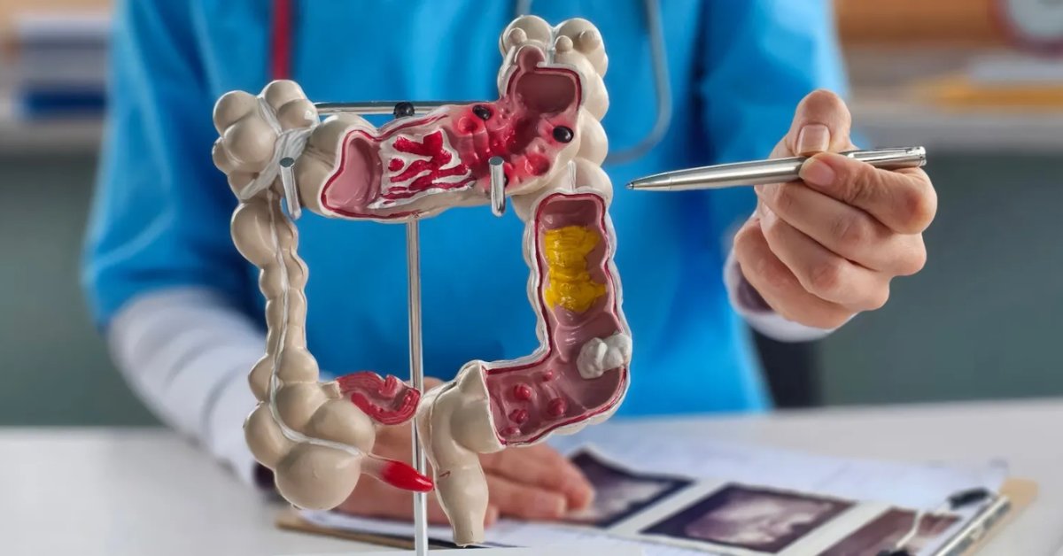 UC San Diego Health Moores Cancer Center tweet media