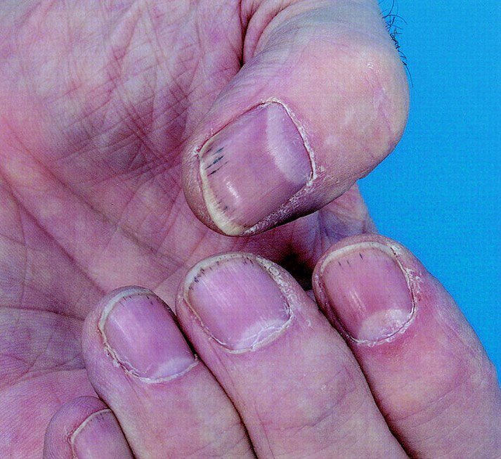 ريان | MD1TALK🌟 tweet media