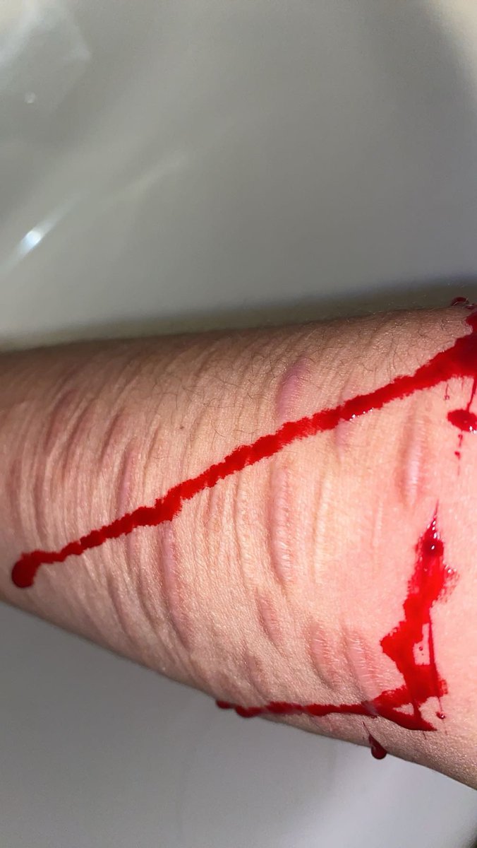 🧟 -´・❥ Wɪʟʟ Tʜᴇ Wɪsᴇ ❥・`- 🧟 tweet media