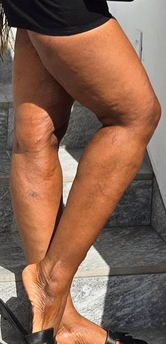 Lobistars Nanny tweet media