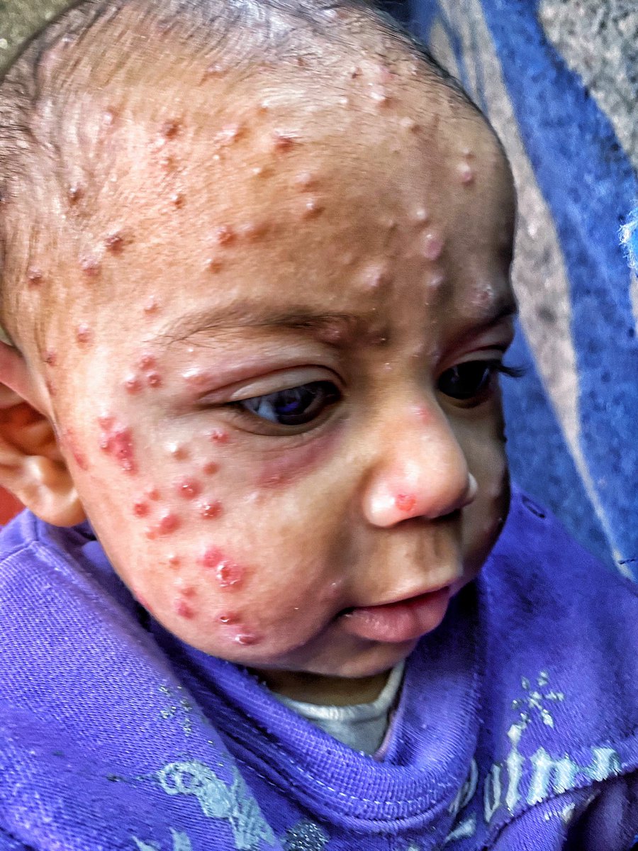 Mahmoud 🍉𝕏 tweet media