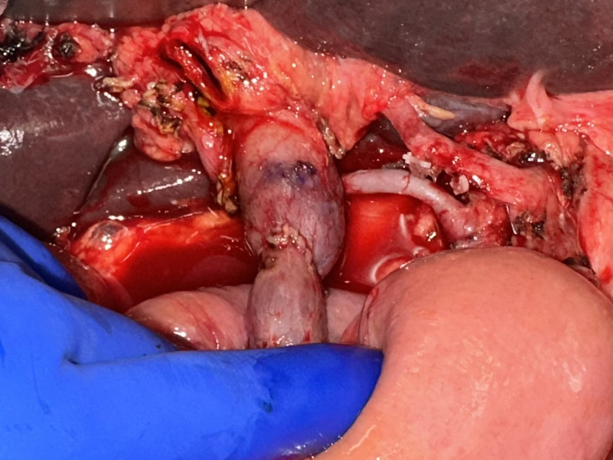 Ziad Awad, MD, FACS tweet media