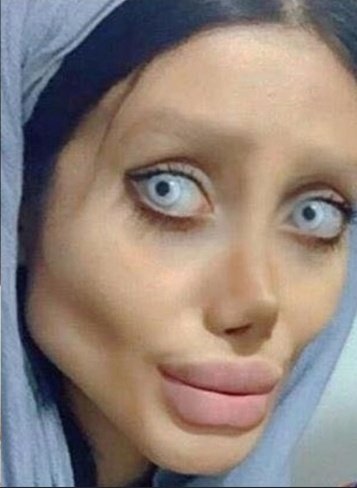 Finha 🍉 tweet media