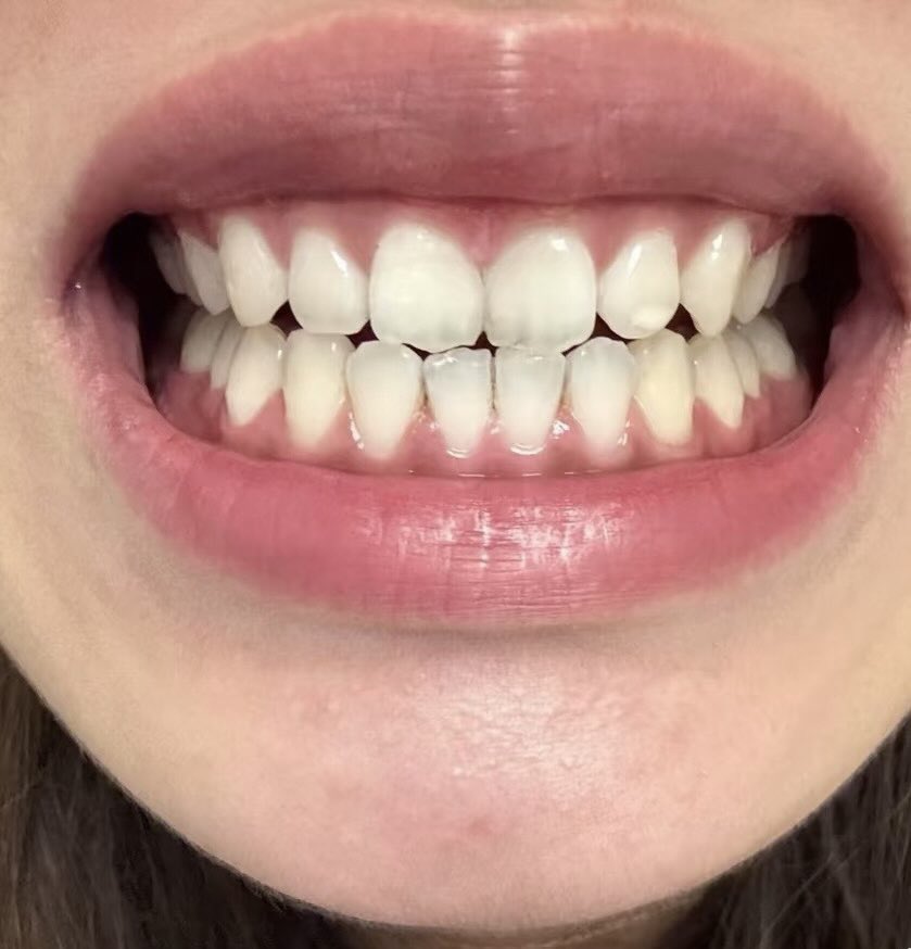 مَيساء | Miysa tweet media