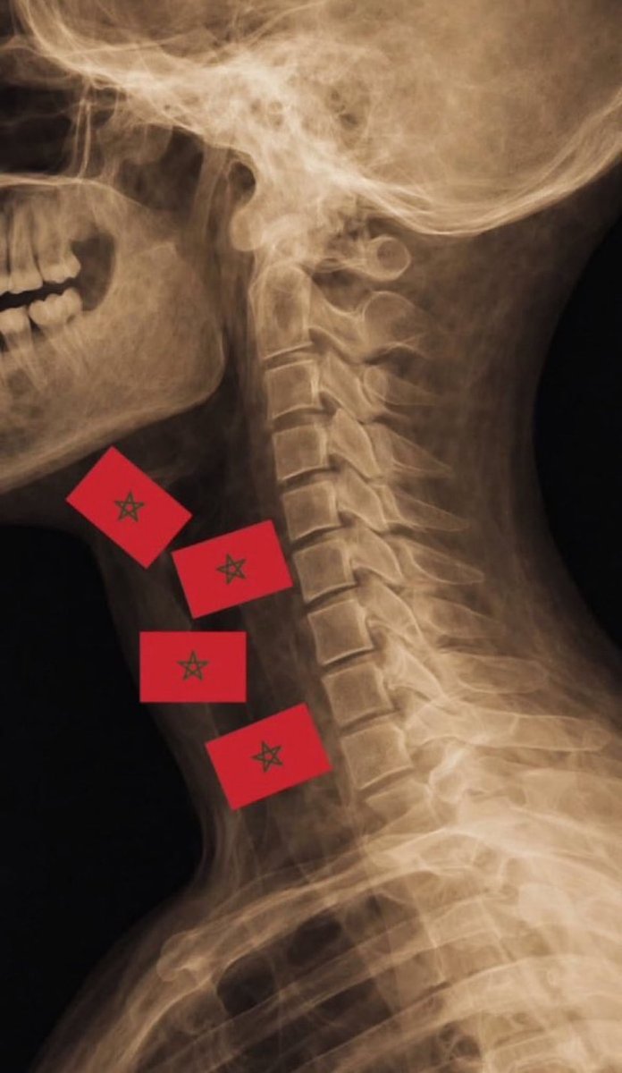 𝓐𝓶𝓷•❀🇲🇦⭐️⭐️ tweet media