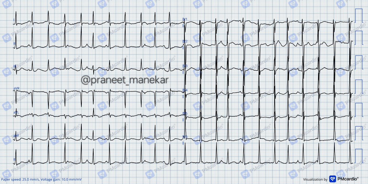Dr. Praneet Manekar tweet media