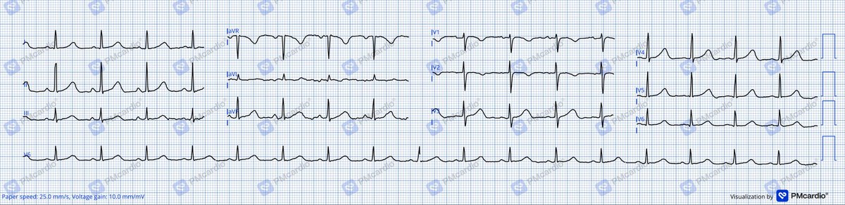 Dr. Praneet Manekar tweet media