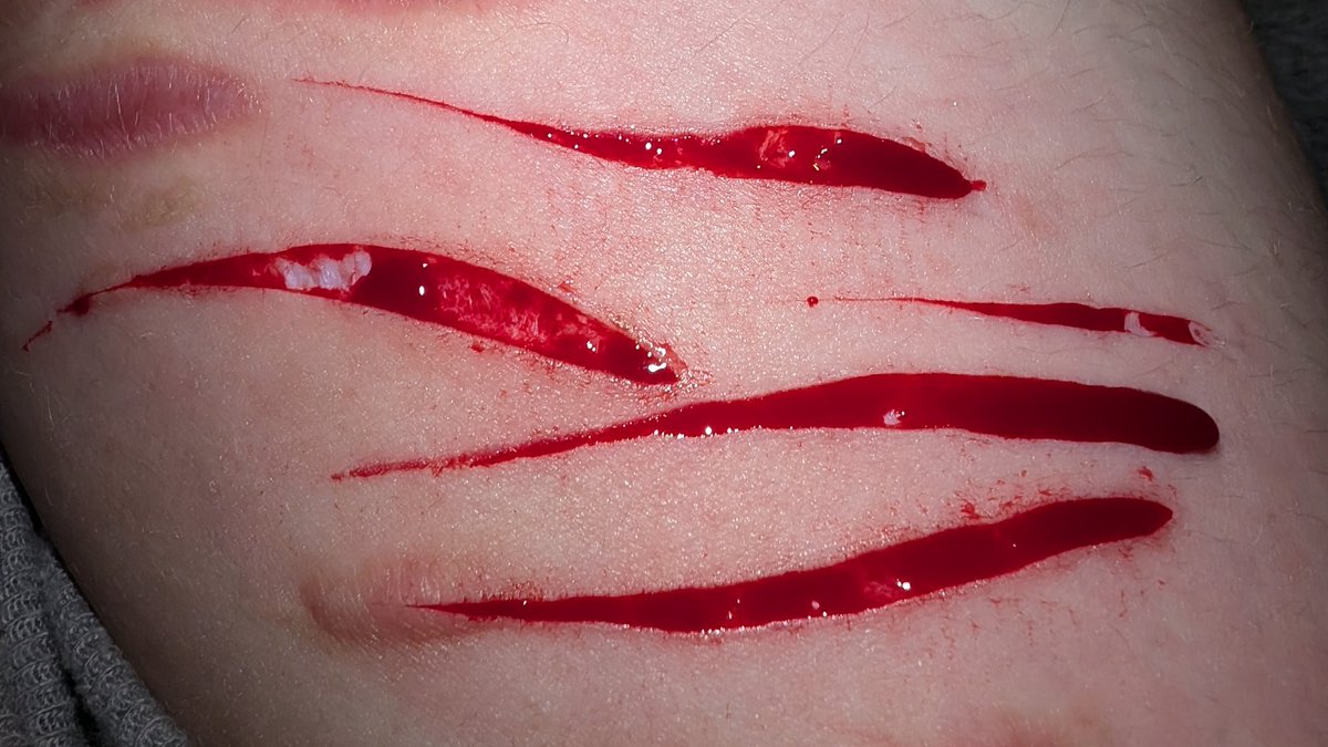 sonic of shedtwt .ᐟ ᡣ𐭩 tweet media