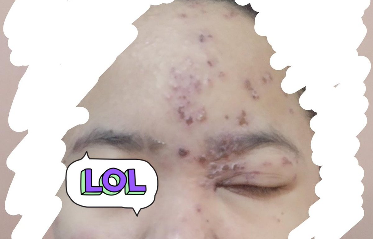 kwakkk🪿🍃 tweet media