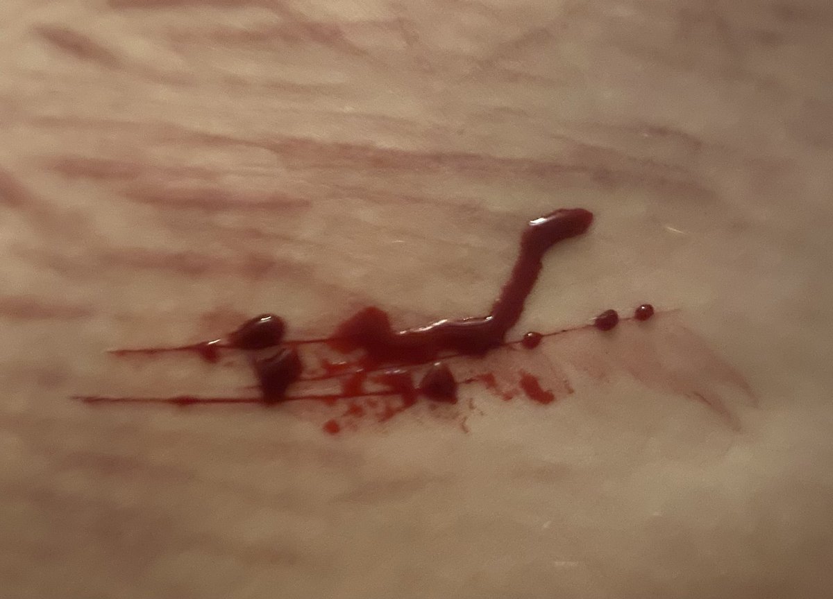 yurilover625 tweet media