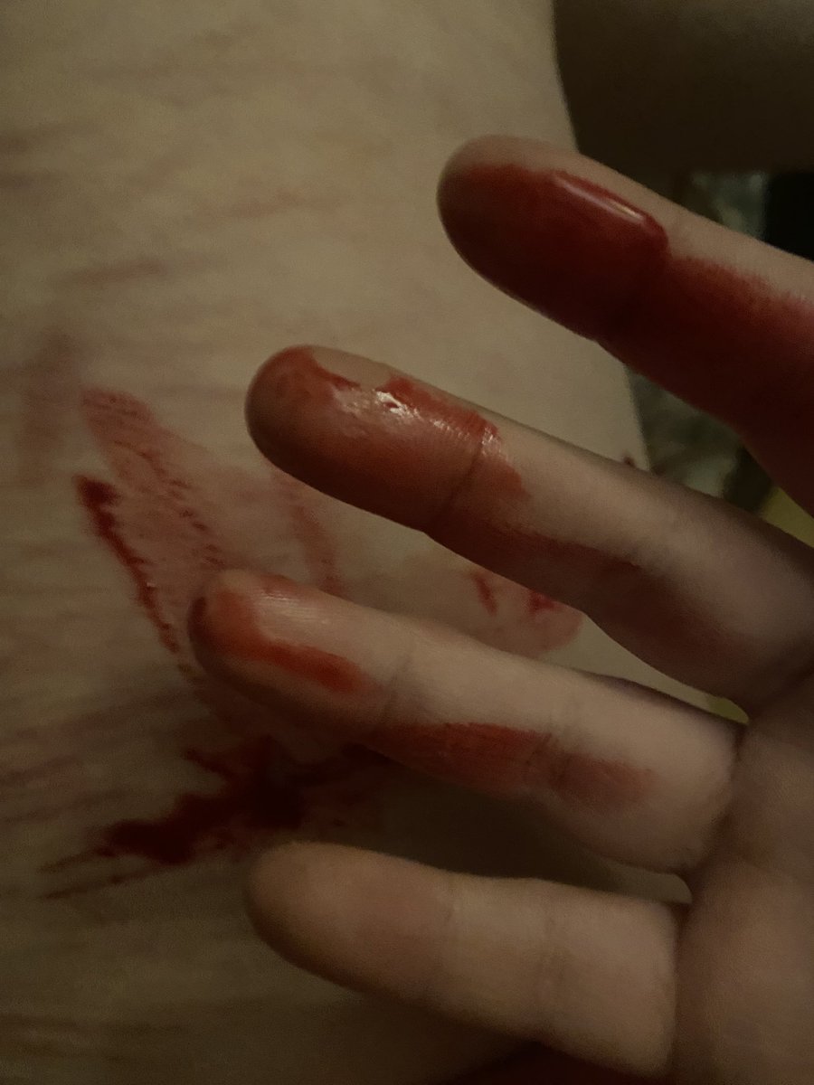 yurilover625 tweet media