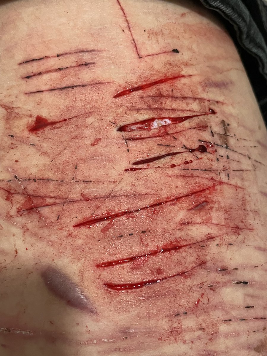 ᴍɪᴍɪ 𖦹 sʜᴇᴅᴛᴡᴛ ⋆˚࿔ tweet media