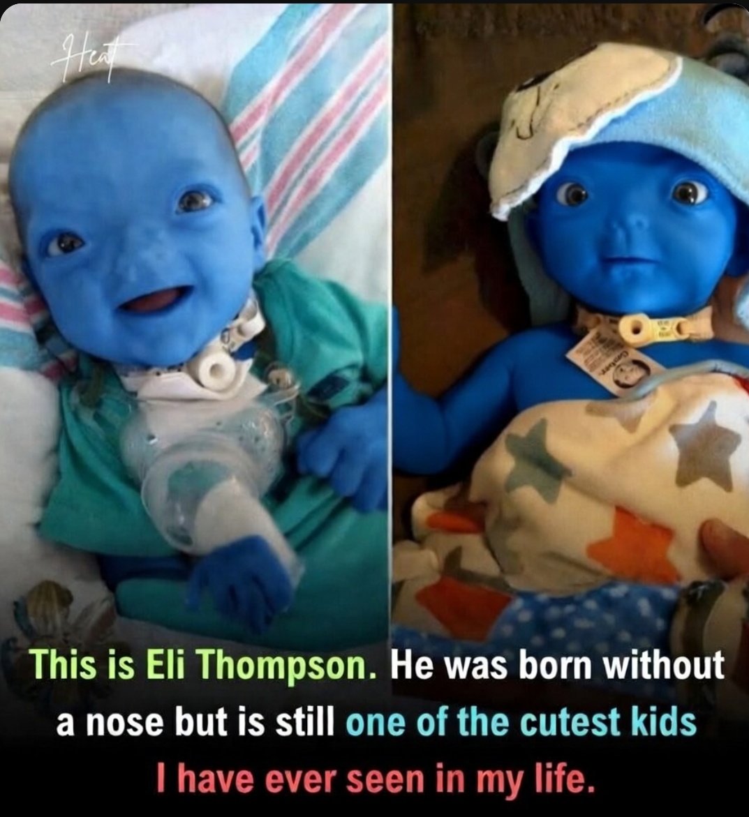 𝑸𝒁𝑼𝑺𝑬𝑹 tweet media