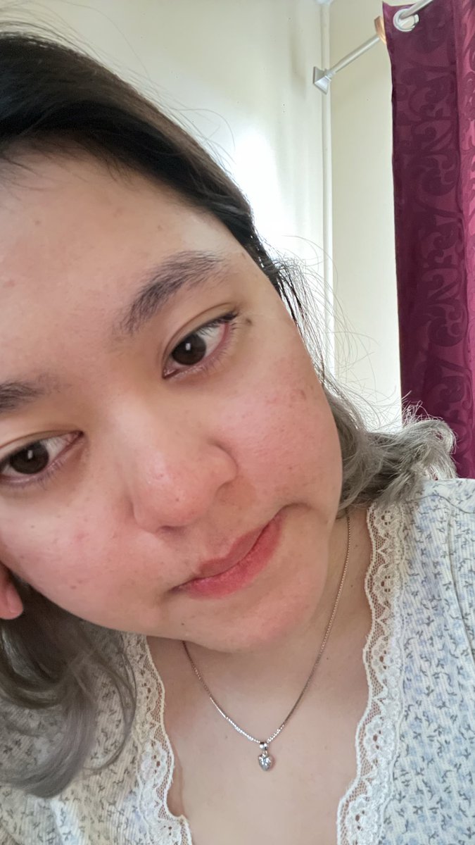 ‎ ale ale tweet media