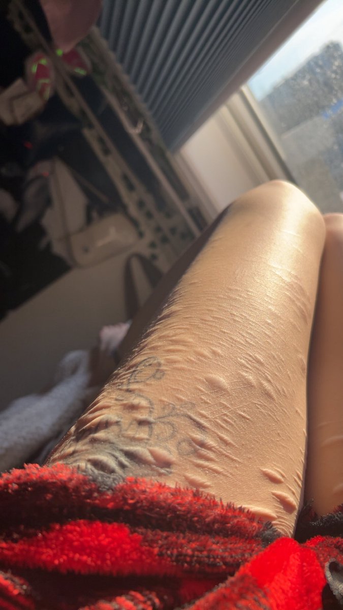 Mellow080408's tweet photo. I think this is the most beautiful way to capture my scars https://t.co/FdjnNUzBCL