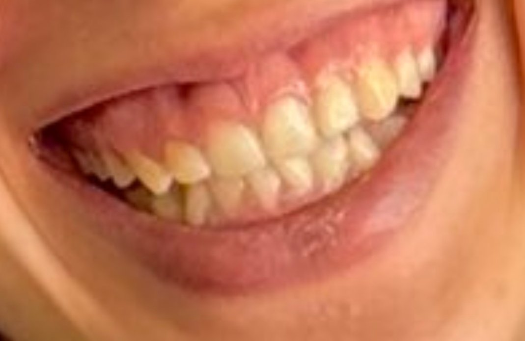 Patroclo, el inmortal. MK-XI🇺🇦🇮🇱🇺🇲 tweet media