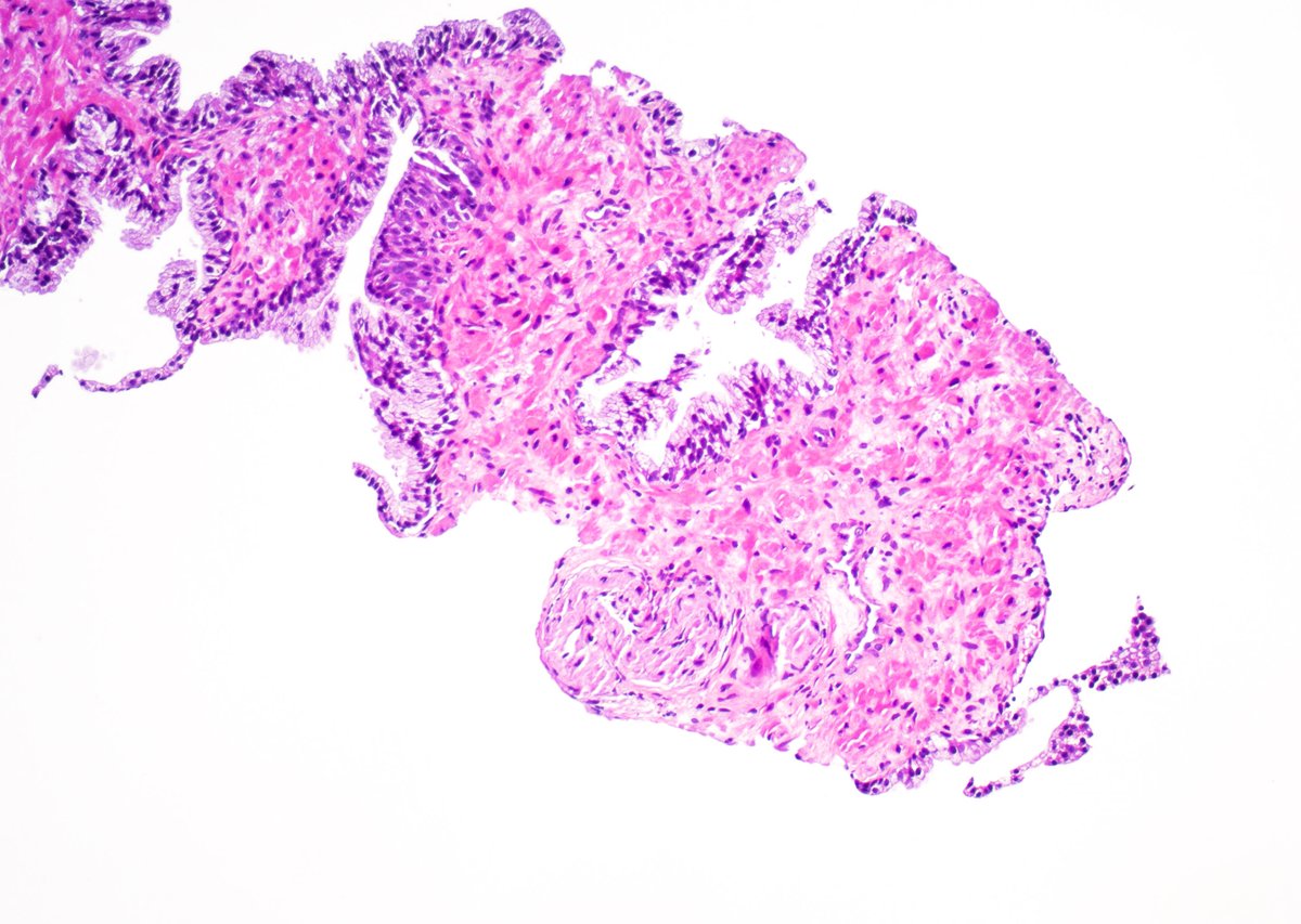 Guannan Zhang ，张冠楠，MD, PhD tweet media