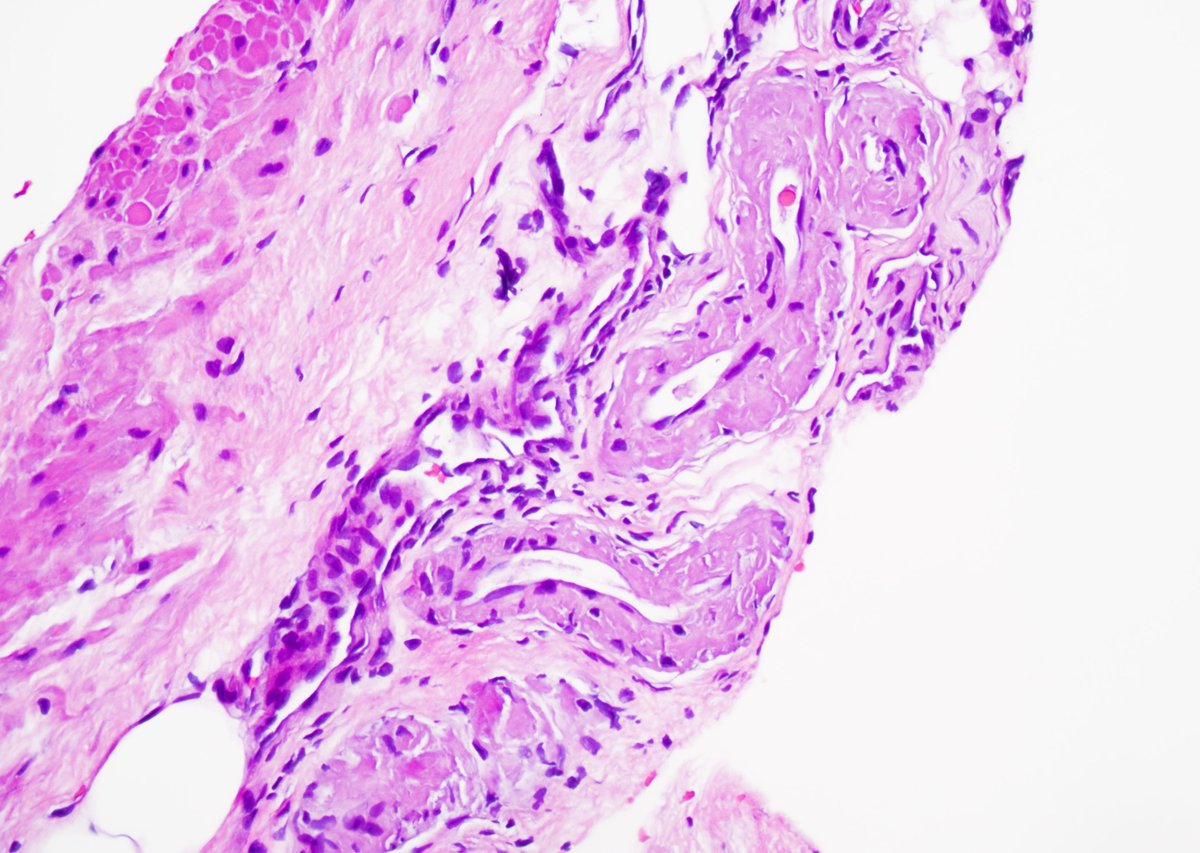 Guannan Zhang ，张冠楠，MD, PhD tweet media