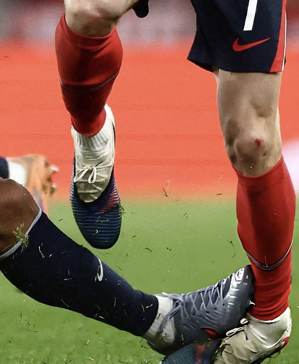 Só Comento tweet media