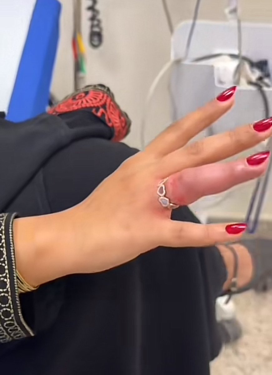 عزيز تقني tweet media