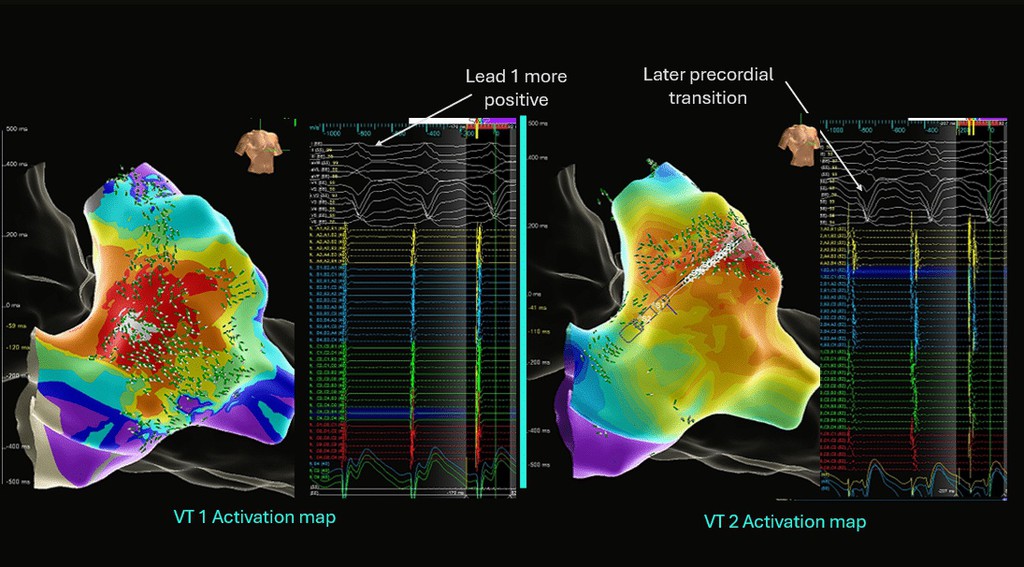 Cardiac Physiology in Practice tweet media