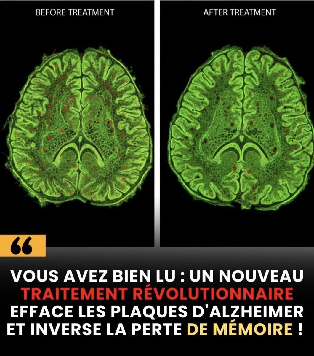 IbnAugustin_Deus ex Machina tweet media