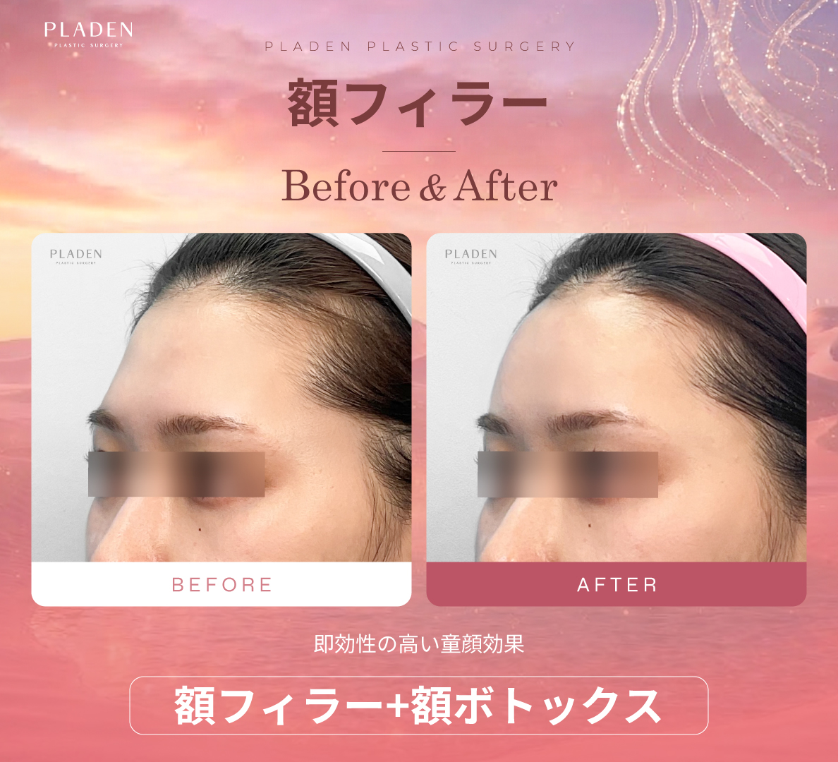 【公式】プラデン美容整形外科 tweet media