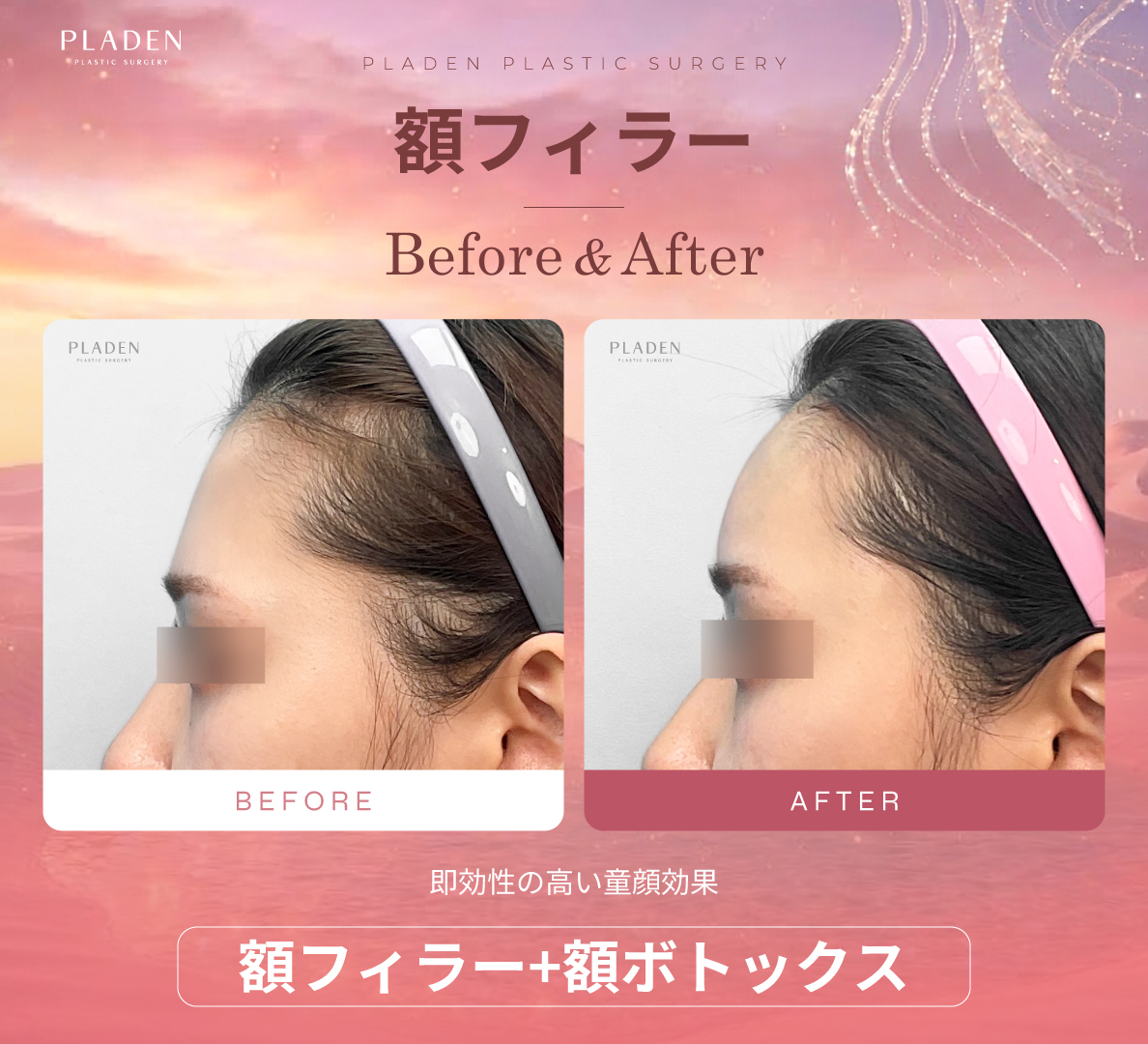 【公式】プラデン美容整形外科 tweet media