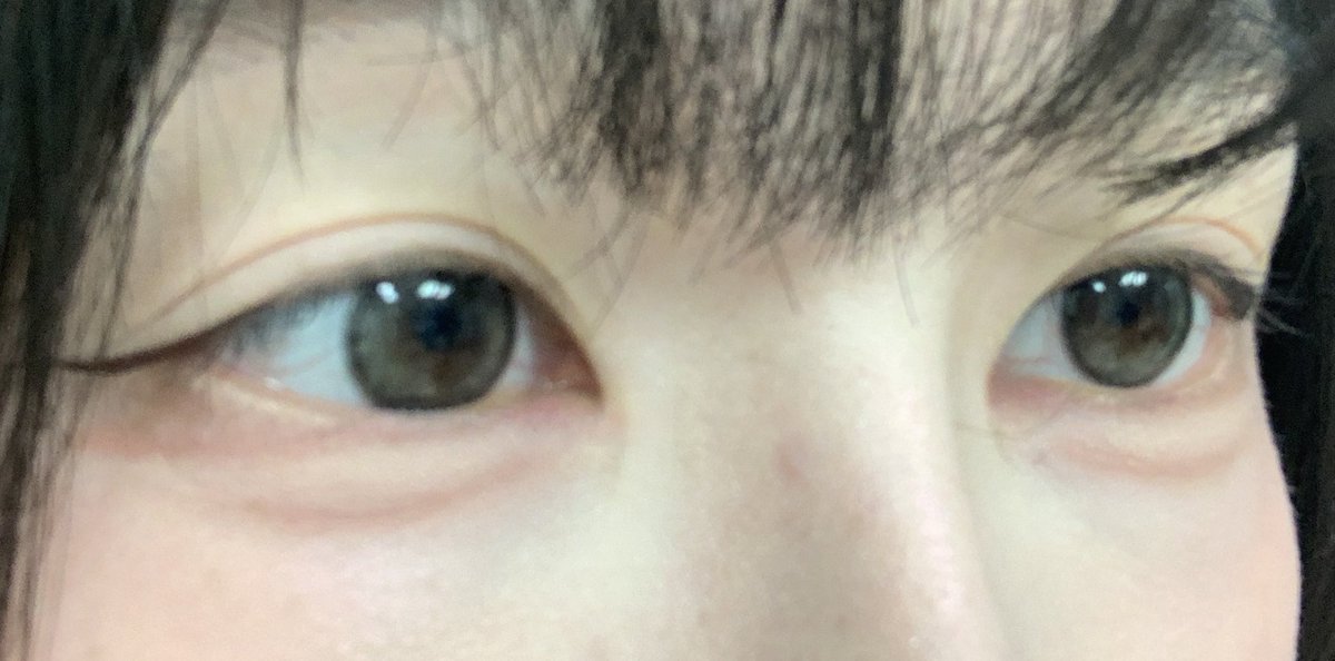 ffffff_co's tweet photo. 팀애교살없음 모여라

저는 태초부터 애교집도 작고 살도 없어서 맨날 그리고 다니는데 친구/직장동료가 인증한 애교살 만들기 장인이 되어벌임 https://t.co/zIJlZibaEP