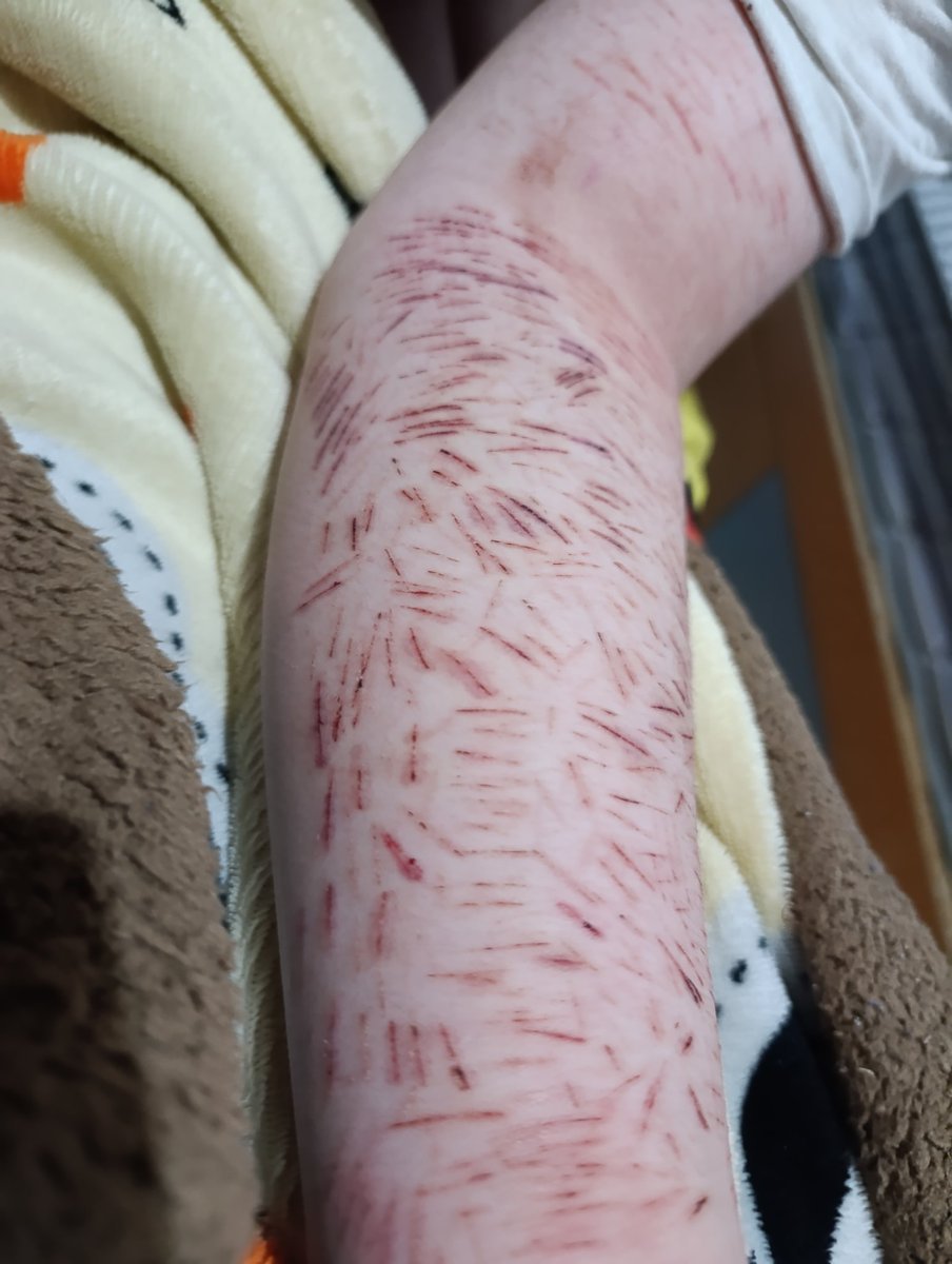 DoctoraTekate tweet media