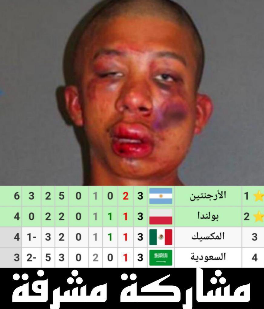 ، ﮼محب ﮼محمد ﮼امين ﮼تكروني 92👈🏾🩸المؤسس tweet media