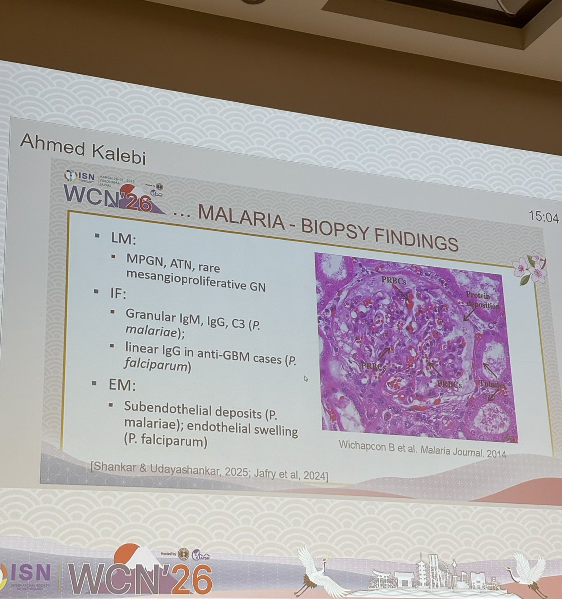 International Society of Glomerular Disease tweet media