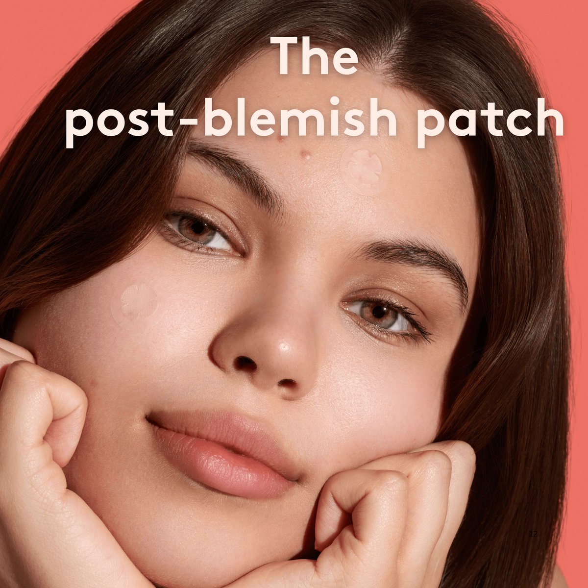 Glowvera11's tweet photo. Fade dark spots fast—no fuss, no harsh treatments.

These breakout patches target hyperpigmentation, brighten post-acne marks, and start working in just 4 hours.

Clearer, smoother skin—one patch away. ✨

For my details click my link 🔗 https://t.co/a9b4VC0Cf5