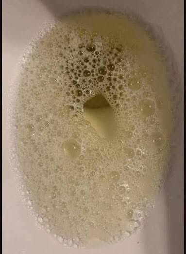 kgadi♠️ tweet media