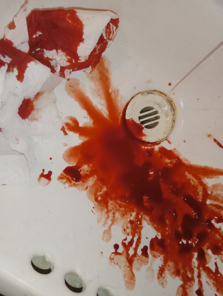 ꧁ 𝖄𝖚𝖎 ꧂—🥩 tweet media