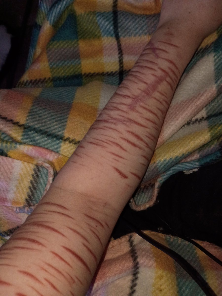 emily of shedtwt tweet media