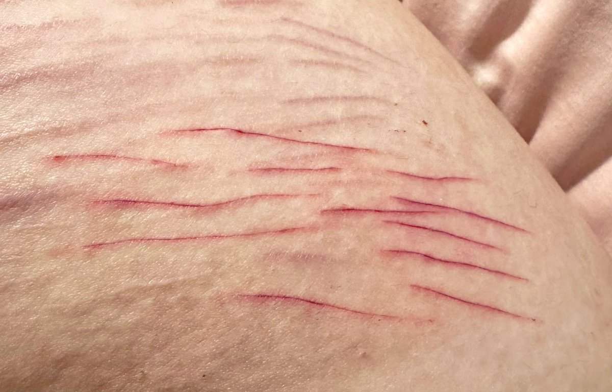 𑣲 Poland of Shtwt જ⁀➴ aka fiona ࣪𝜗𝜚 tweet media