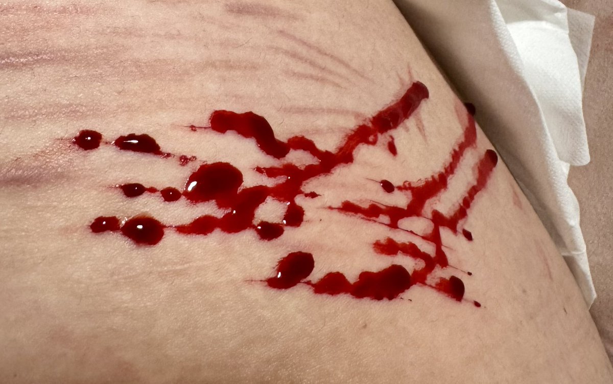 𑣲 Poland of Shtwt જ⁀➴ aka fiona ࣪𝜗𝜚 tweet media