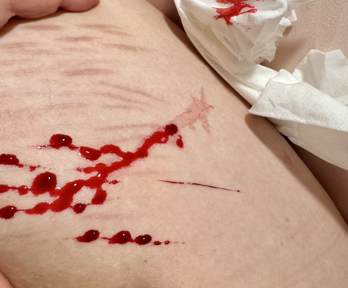 𑣲 Poland of Shtwt જ⁀➴ aka fiona ࣪𝜗𝜚 tweet media