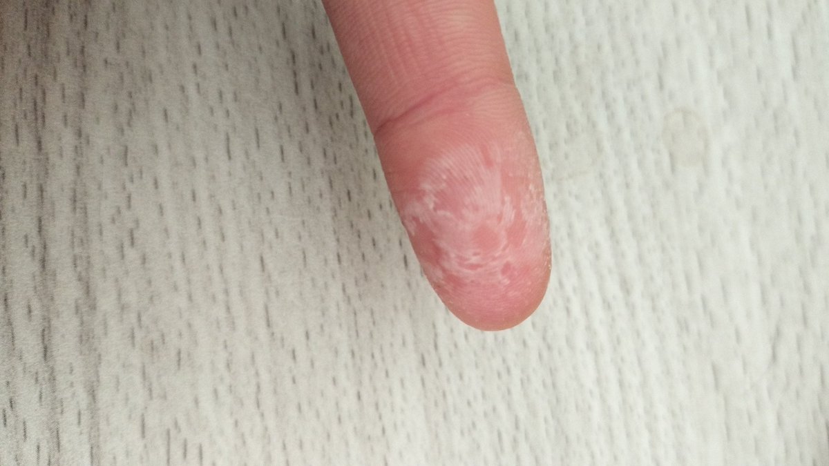 とがった月 tweet media