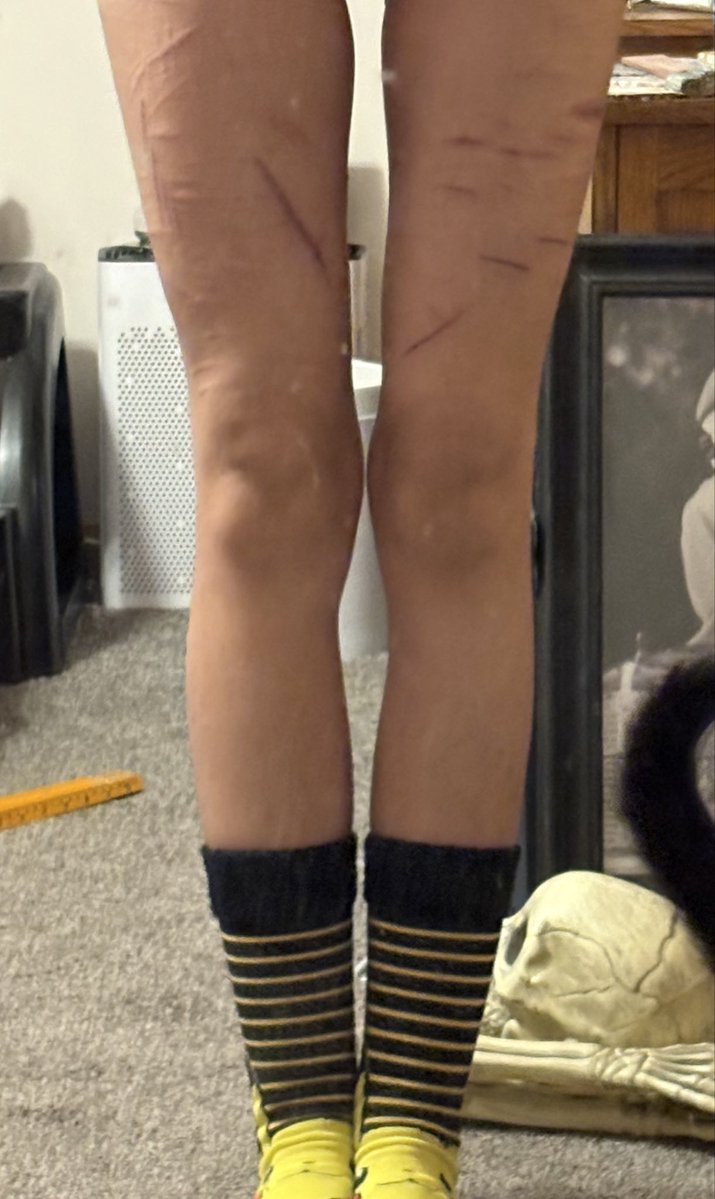 sharlotkov (9.1/40lbs) tweet media