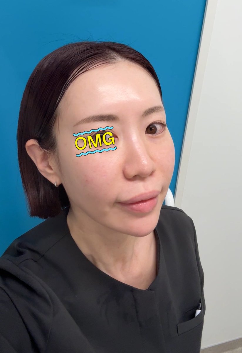 koto🪄ソルクリ美容カウンセラー tweet media