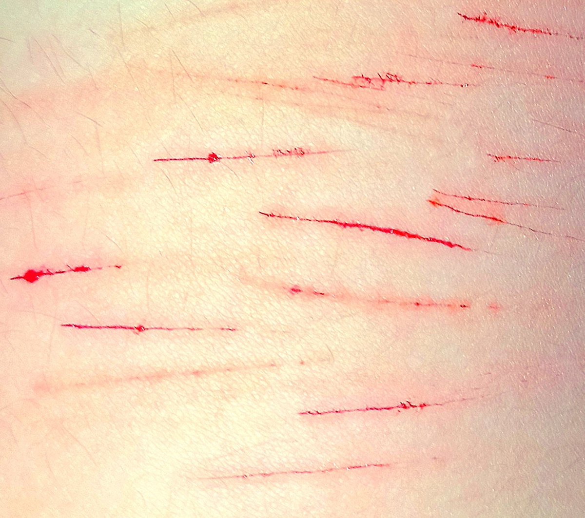 mephone4 of shtwt tweet media