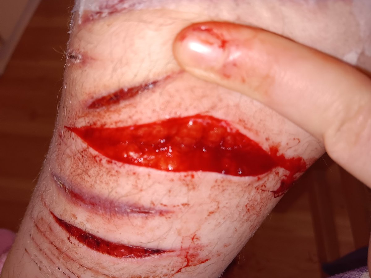 chocolatehurtstopurge tweet media